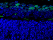 A Good PAX6 Antibody From ThermoFisher Scientific