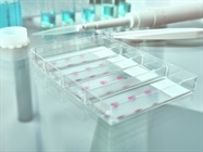 Robust Results for scRNA-seq from Matched FFPE and Freshly Fixed Samples