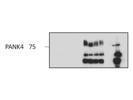 Antibody IP'd PANK4 From Bethyl Laboratories