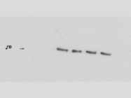 Highly Recommended Antibody From Cell Signaling for Western Blot
