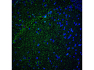 Great Anti-Albumin Antibody From Abcam for Rat Samples