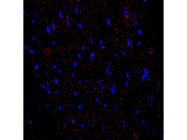 Cdkn1a Probe From ACD Bio for RNA-ISH in Rat Samples
