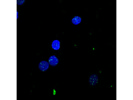 Average Phospho-Histone H2A.X From Cell Signaling
