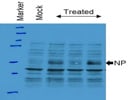 Noteworthy Phospho m-TOR Antibody From Cell Signaling Technology