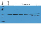A Highly Specific Antibody From Santa Cruz to Detect Beta Tubulin