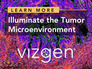 Illuminate the Tumor Microenvironment with MERSCOPE