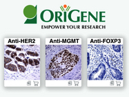 Antibodies Validated for IHC