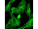 Efficient Secondary Antibody From Invitrogen