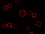 How to Advance Your Research with Biotinylated Chemokines