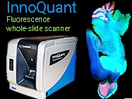 InnoQuant Fluorescence whole-slide scanner