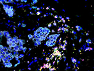 Poster: Increase Throughput in Iterative Immuno-Fluorescent Staining of Cancer Tissue
