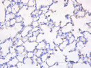 Platelet Immunohistochemistry Using Anti-CD42b From  Abcam