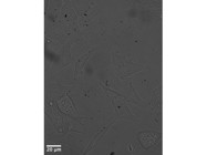 Penicillin-Streptomycin From Millipore Sigma is Ideal for HL-1 Cell Culture