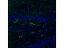 VCAM1 From Abcam for Rat Samples