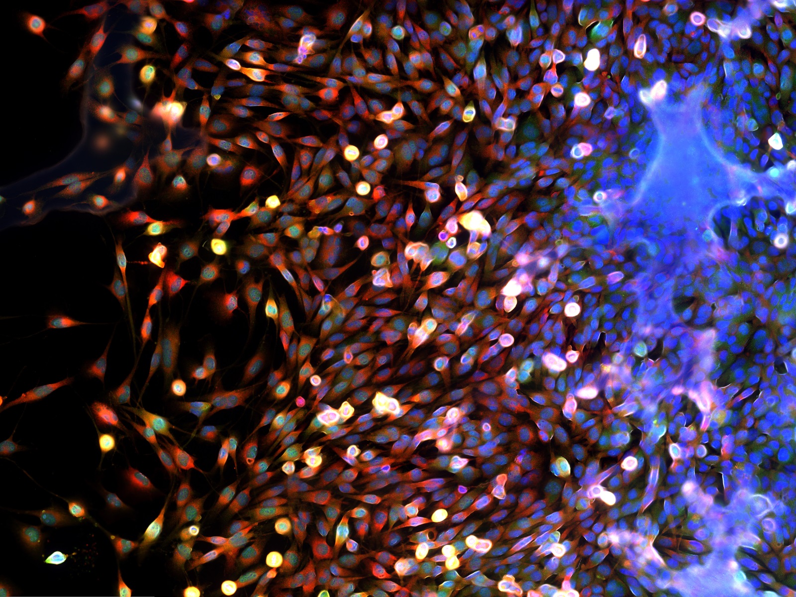  Scaling comparative lung cancer studies using Chromium Single Cell Gene Expression Flex