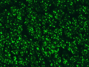 Specific Neurofilament Light Chain Antibody