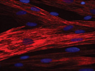 Expensive Yet Sensitive Rabbit Anti-Alpha Smooth Muscle Actin Antibody From Abcam