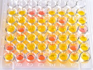 Multiplex Assay Selection and Optimization