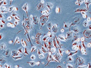 Transient Lentiviral Vector Production in HEK 293T Cells
