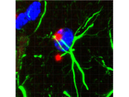 Convenient to Use BaseScope Detection Reagent Kit From Advanced Cell Diagnostics