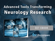 Advanced Tools Transforming Neurology Research