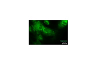 TOM20 Abs From Proteintech Were Used for the Evaluation of Mitochondrial Integrity
