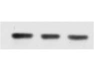 Ideal Actin Monoclonal Antibody for Western Blot