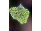 Oct-4 Antibody Worked Great for ICC on iPSCs