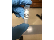 Phospho-IRF Antibody From  Cell Signaling Technology Works Well for Western Blot