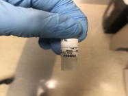 GFP Antibody From Cell Signaling Technology Produces Clear Bands
