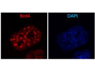 Perfect Antibody From Bethyl Laboratories to Stain Brd4