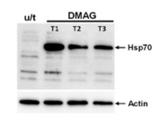 HSP70 Expression After Anti-Cancer Treatment