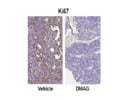 Ki-67 Antibody From Thermo Fisher Was Used as a Marker of Cell Proliferation After DMAG-17 Chemotherapy Treatment.