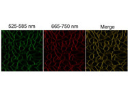 Fluorescent probe for measuring membrane order