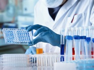 Infographic: Five Factors to Consider for ELISAs