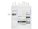 Bag-3 Antibody From Santa Cruz Biotechnology is Perfect for the Detection of YTS NK Cells