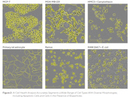 AI-Driven Label-Free Quantification of Cell Viability Using Live-Cell Analysis