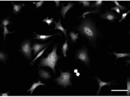 Smad2 Antibody From Cell Signaling Technology Was Easy to Use and Gave Good Results