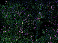 Advances in Immunopeptidomics