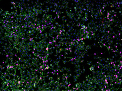Advances in Immunopeptidomics