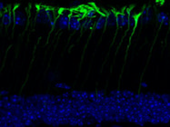 Reliable GFAP Antibody for Astrocytes in the Mouse Retina
