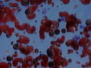 Infographic: Using the Multi-Attribute Method for Antibody Drug Discovery