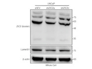 ZIC2 Antibody Test on LNCaP Whole Cell Lysates