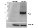 PC-2 Antibody From Santa Cruz is Ideal for the Detection of PC2 by Western Blot