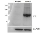 PC-2 Antibody From Santa Cruz is Ideal for the Detection of PC2 by Western Blot
