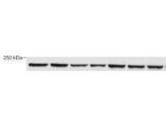 This BRD4 Antibody From Invitrogen is Highly Reliable and Sensitive