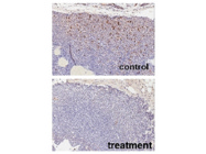 Survivin mAb From Cell Signaling Was Used as a Marker of Cancer Process After DMAG-17 Chemotherapy Treatment.