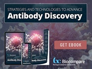 Strategies and Technologies to Advance Antibody Discovery