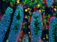 From Cold to Hot—Immunophenotyping Tumors and Their Microenvironments