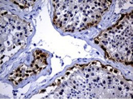 Antibody Panels for Key Immunology Research